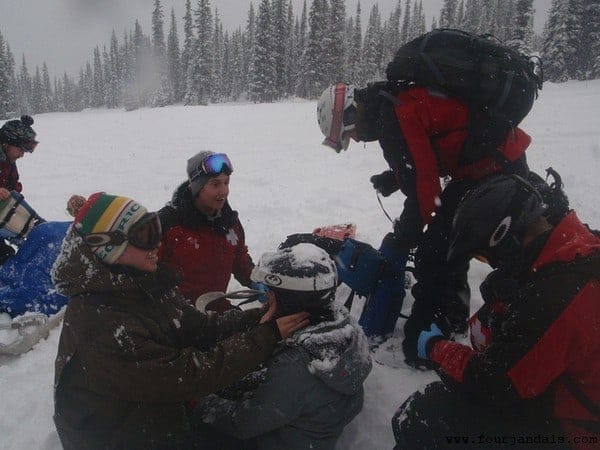 Broken Collarbone on Marmot Basin Ski Area